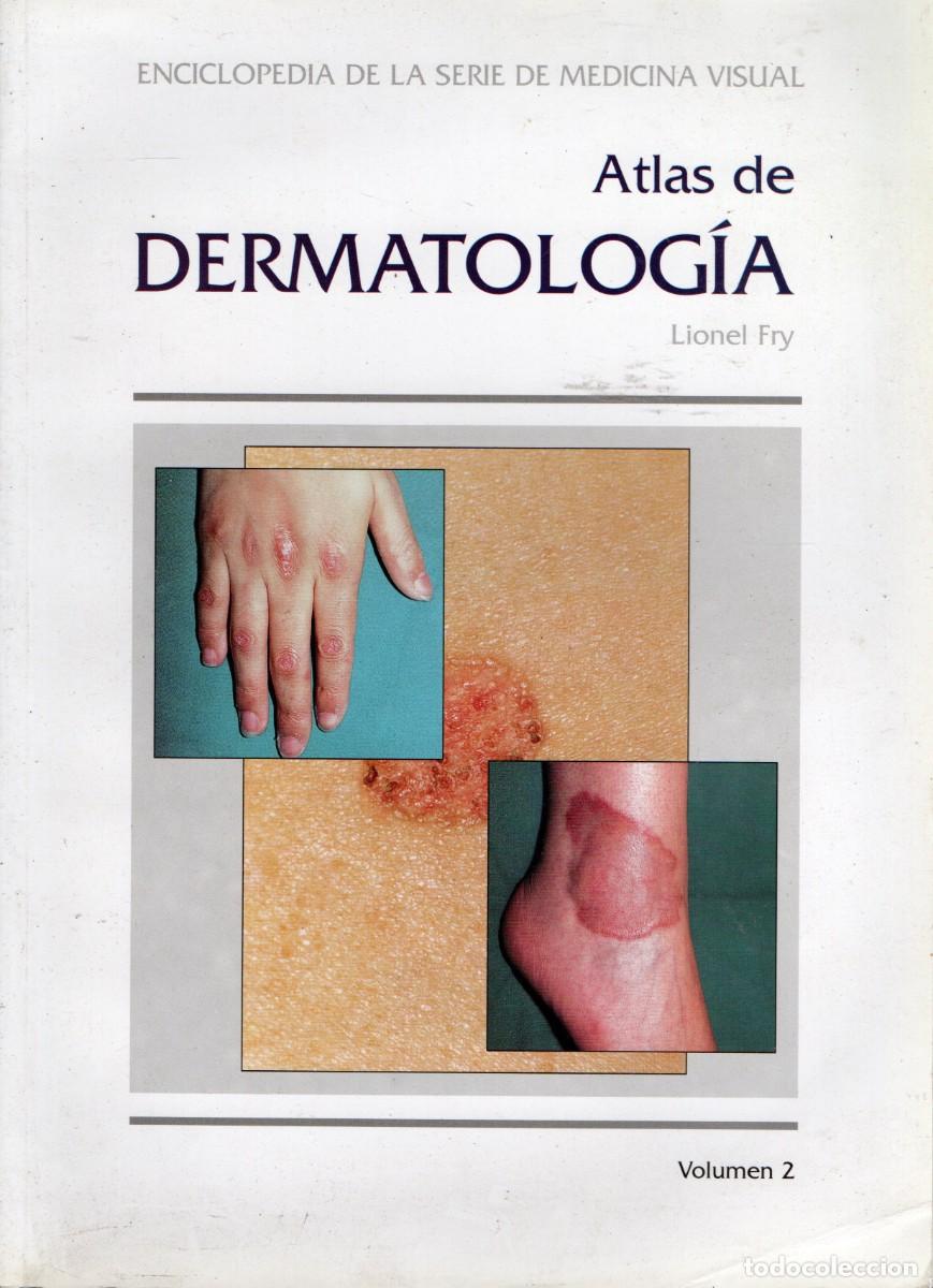 Libros de segunda mano: ATLAS DE DERMATOLOGIA VOL. 2. FRY, LIONEL. A-MEDI-1259