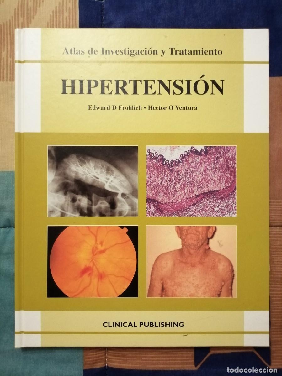 Libros de segunda mano: Bd. Atlas de Investigaci&oacute;n y Tratamiento Hipertensi&oacute;n (Edward D. Frohlich y Hector O. Ventura)