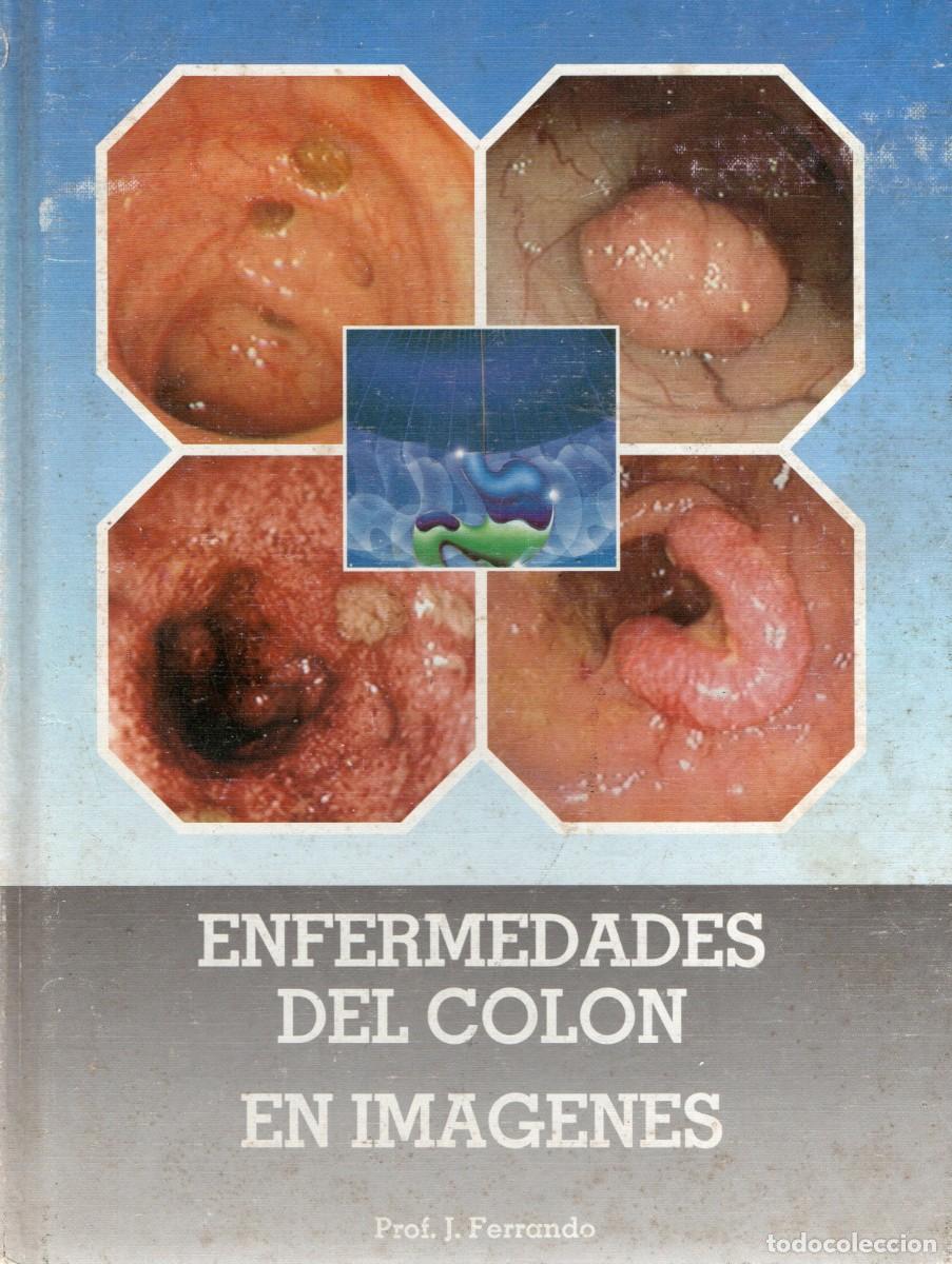 Libros de segunda mano: ENFERMEDADES DEL COLON EN IM&Aacute;GENES. FERRANDO, J. A-MEDI-1297