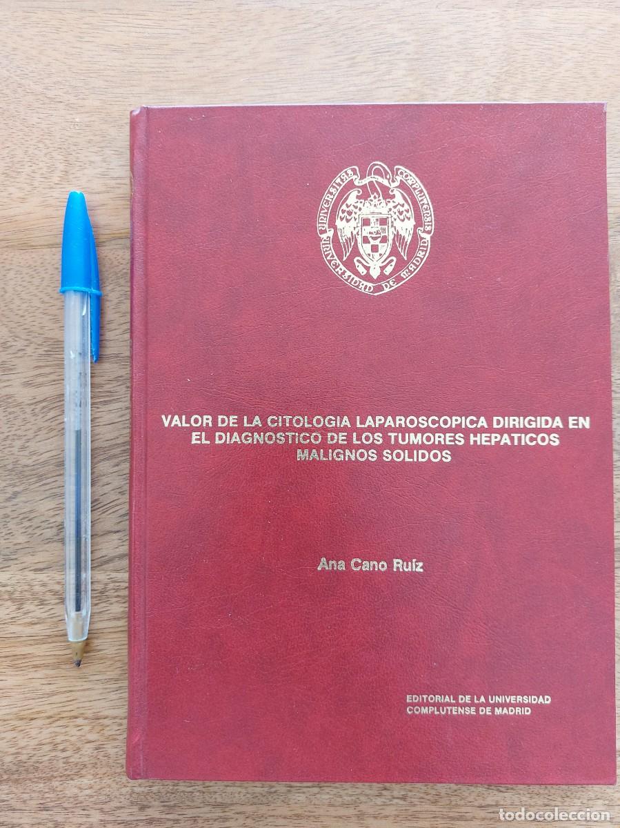 Libros de segunda mano: VALOR DE LA CITOLOGIA LAPAROSCOPICA DIRIGIDA EN EL DIAGNOSTICO DE LOS TUMORES HEPATICOS MALIGNOS