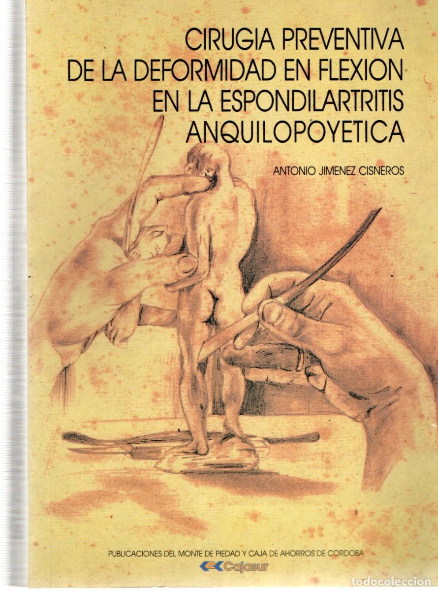 Libros de segunda mano: CIRUGIA PREVENTIVA DE LA DEFORMIDAD EN FLEXION EN LA ESPONDILARTRITIS ANQUILOPOYETICA. A-MEDI-1436