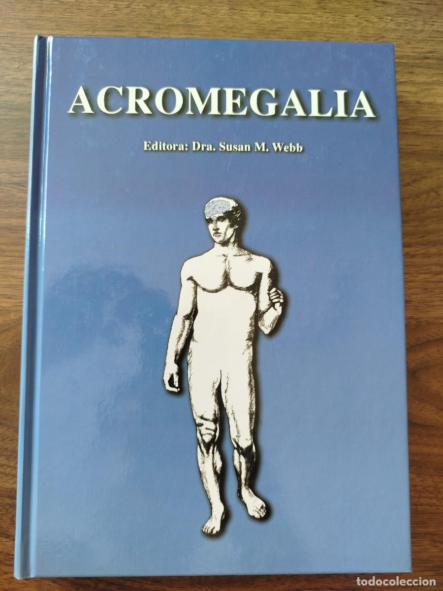 Libros de segunda mano: Libro Acromegalia de Susan Webb. Endocrinolog&iacute;a.