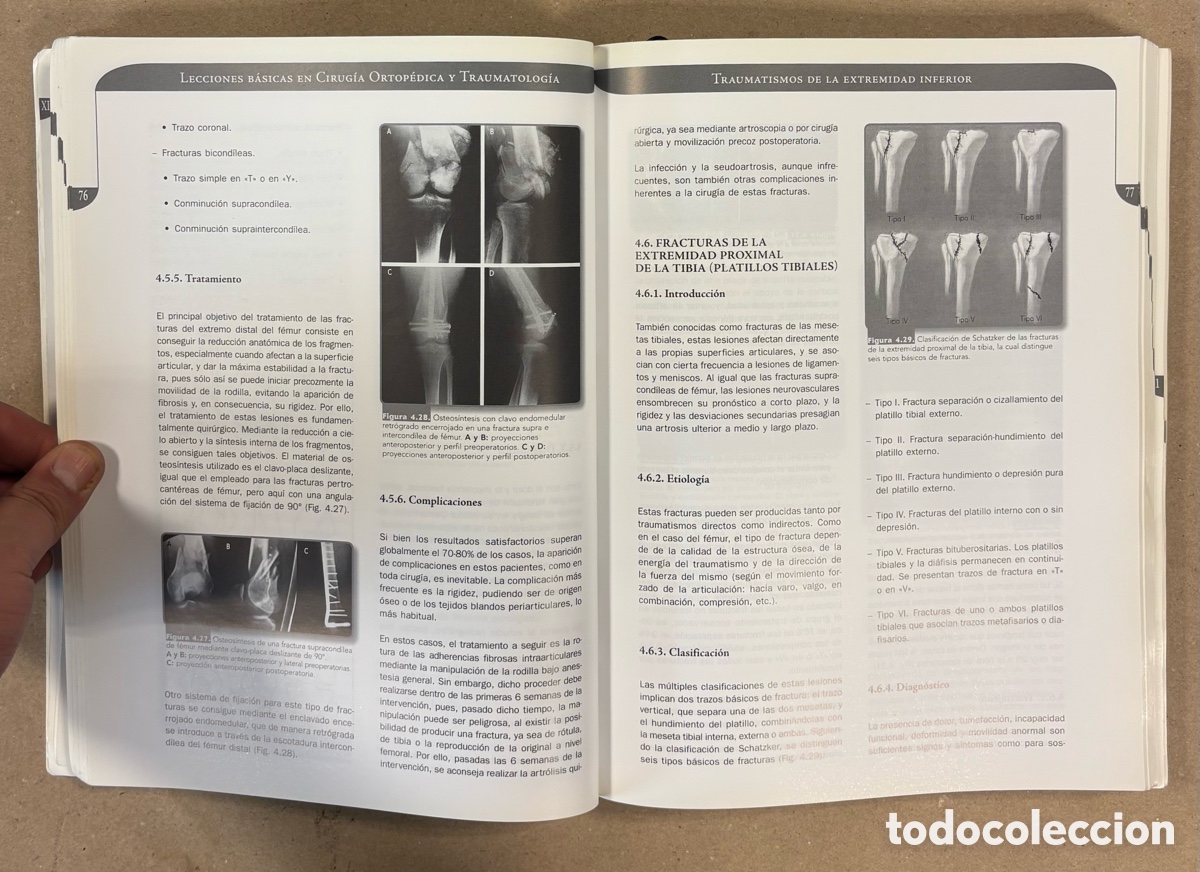 Libros de segunda mano: LECCIONES B&Aacute;SICAS EN CIRUG&Iacute;A ORTOP&Eacute;DICA Y TRAUMATOLOG&Iacute;A. IGNACIO PROUBASTA EDITOR. - Foto 4