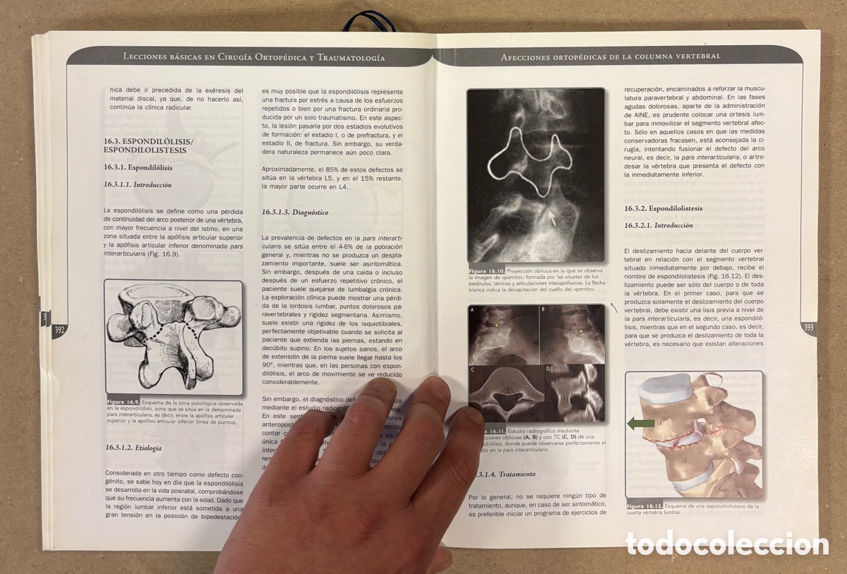 Libros de segunda mano: LECCIONES B&Aacute;SICAS EN CIRUG&Iacute;A ORTOP&Eacute;DICA Y TRAUMATOLOG&Iacute;A. IGNACIO PROUBASTA EDITOR. - Foto 7