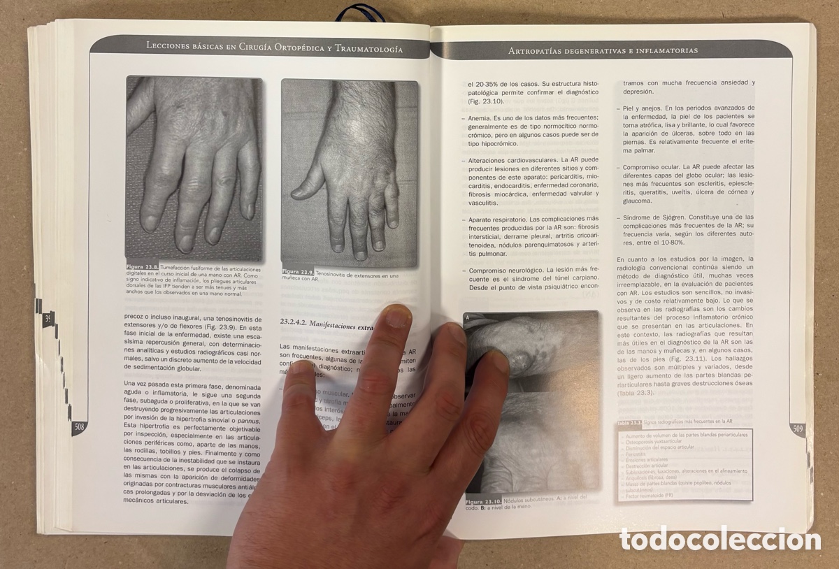 Libros de segunda mano: LECCIONES B&Aacute;SICAS EN CIRUG&Iacute;A ORTOP&Eacute;DICA Y TRAUMATOLOG&Iacute;A. IGNACIO PROUBASTA EDITOR. - Foto 8