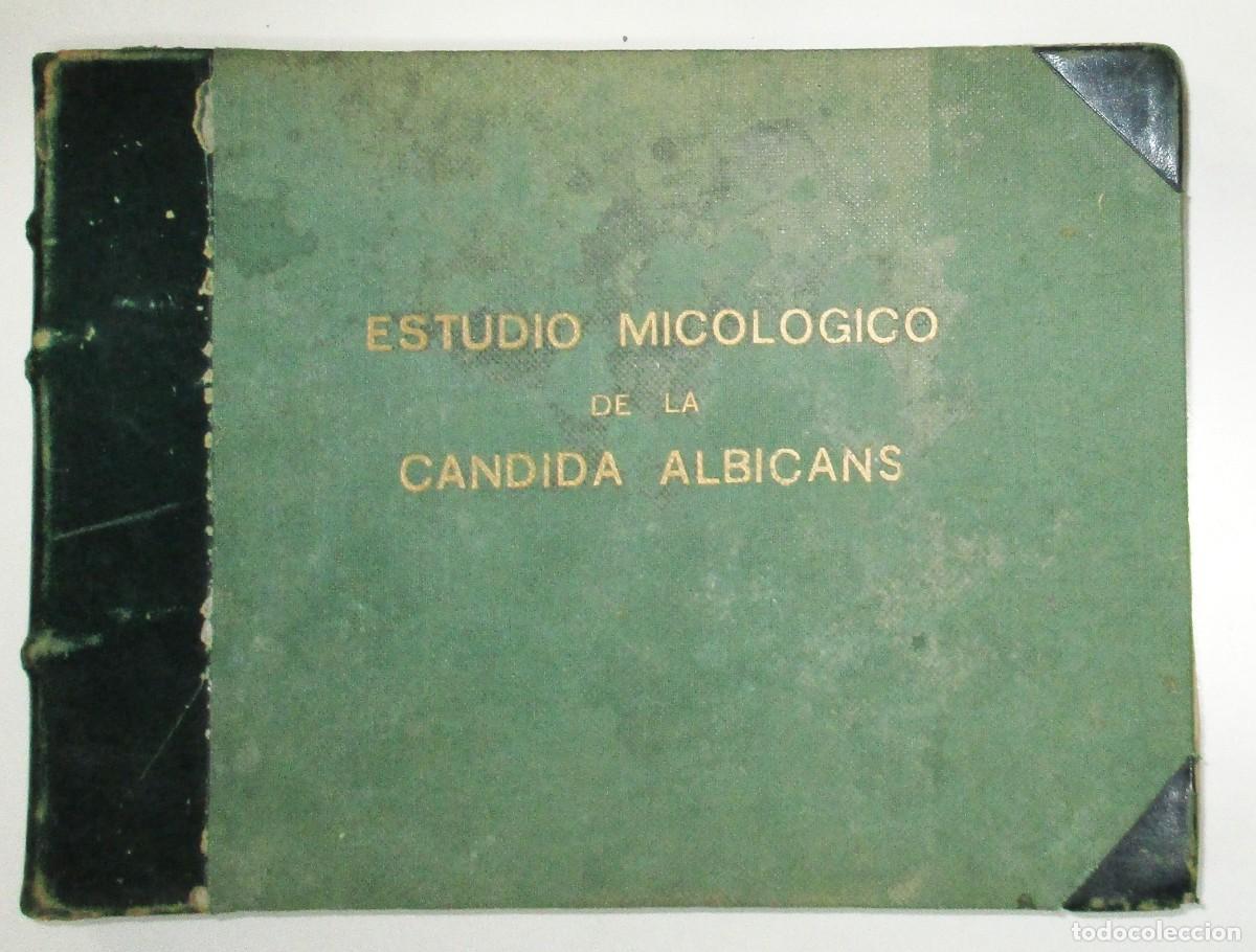 Gebrauchte B&uuml;cher: ESTUDIO MICOL&Oacute;GICO DE LA C&Aacute;NDIDA ALBICANS. TESIS DOCTORAL. JOS&Eacute; GONZ&Aacute;LEZ ARISTIZ&Aacute;BAL, 1958.