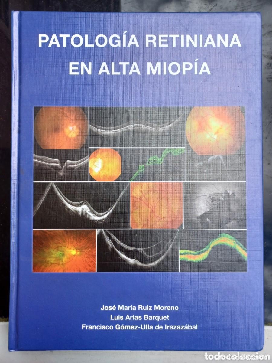 Libros de segunda mano: Patologia retiniana en alta miop&iacute;a