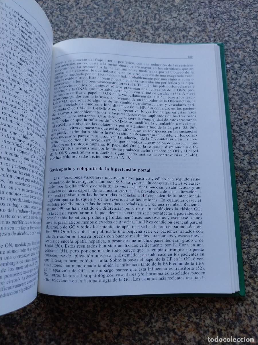 Libros de segunda mano: LIBRO DEL A&Ntilde;O -- APARATO DIGESTIVO -- 1996 -- - Foto 2