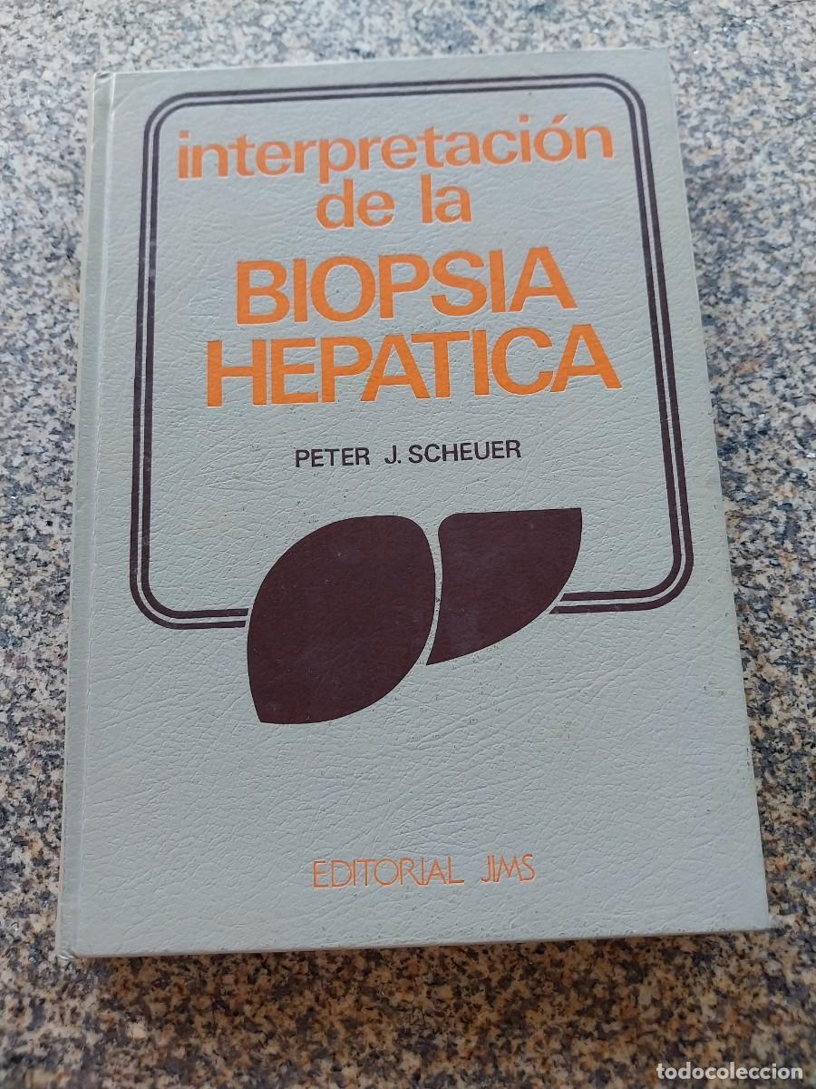 Livres d'occasion: INTERPRETACION DE LA BIOPSIA HEPATICA -- PETER SCHEUER -- 1975 --