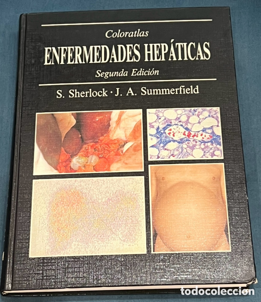 Libros de segunda mano: Libro. S. Sherlock, J. A. Summerfield. &ldquo;Coloratlas Enfermedades Hepaticas&rdquo;. Mosby-Year Book. 1992.