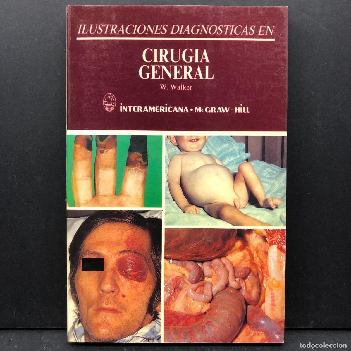 Libros de segunda mano: ILUSTRACIONES DIAGNOSTICAS EN CIRUGIA GENERAL - W. WALKER - INTERAMERICANA-MCGRAW HILL / 3593