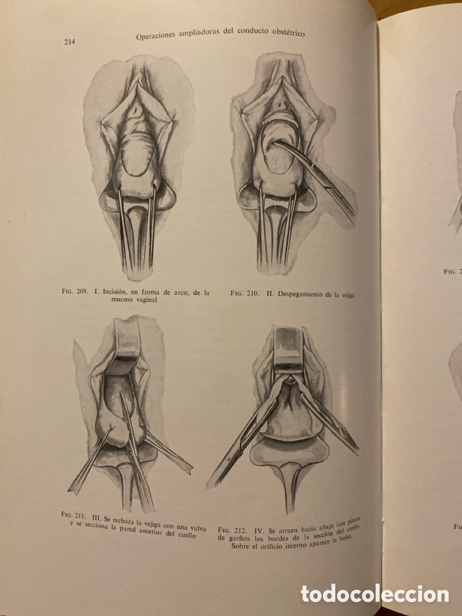 Libros de segunda mano: Libro Operaciones Obst&eacute;tricas - Foto 4