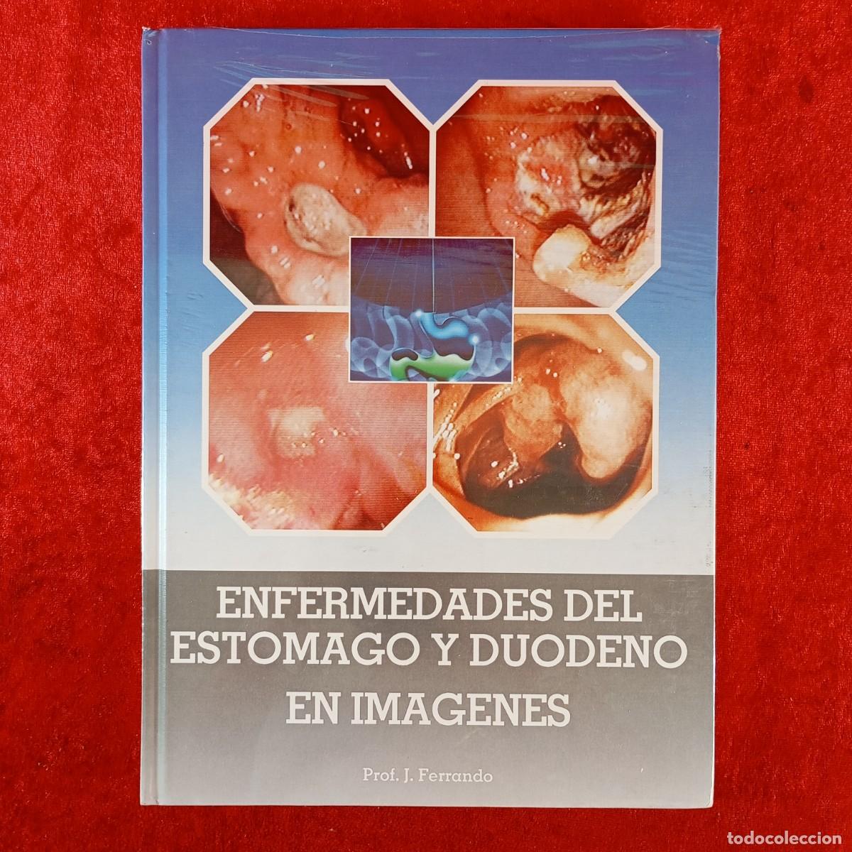 Libri di seconda mano: ENFERMEDADES DEL ESTOMAGO Y DUODENO EN IMAGENES - PROF. J. FERRANDO - PRECINTADO / 4522