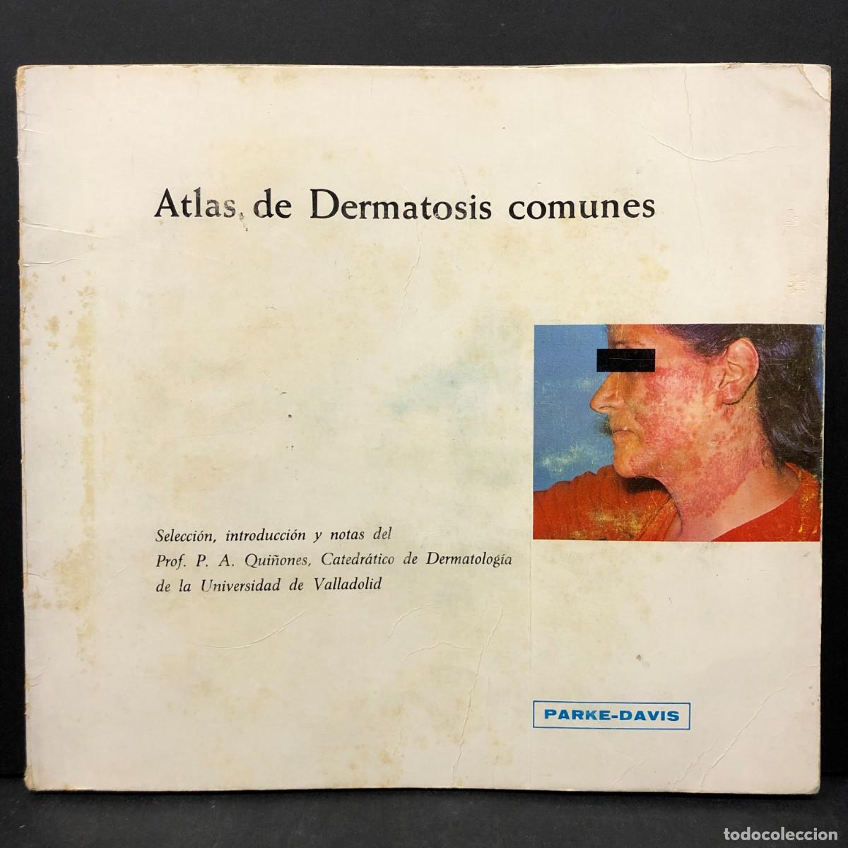 Libros de segunda mano: ATLAS DE DERMATOSIS COMUNES - PARKE-DAVIS - A. QUI&Ntilde;ONES, CATEDR&Aacute;TICO DE DERMATOLOG&Iacute;A / 4722