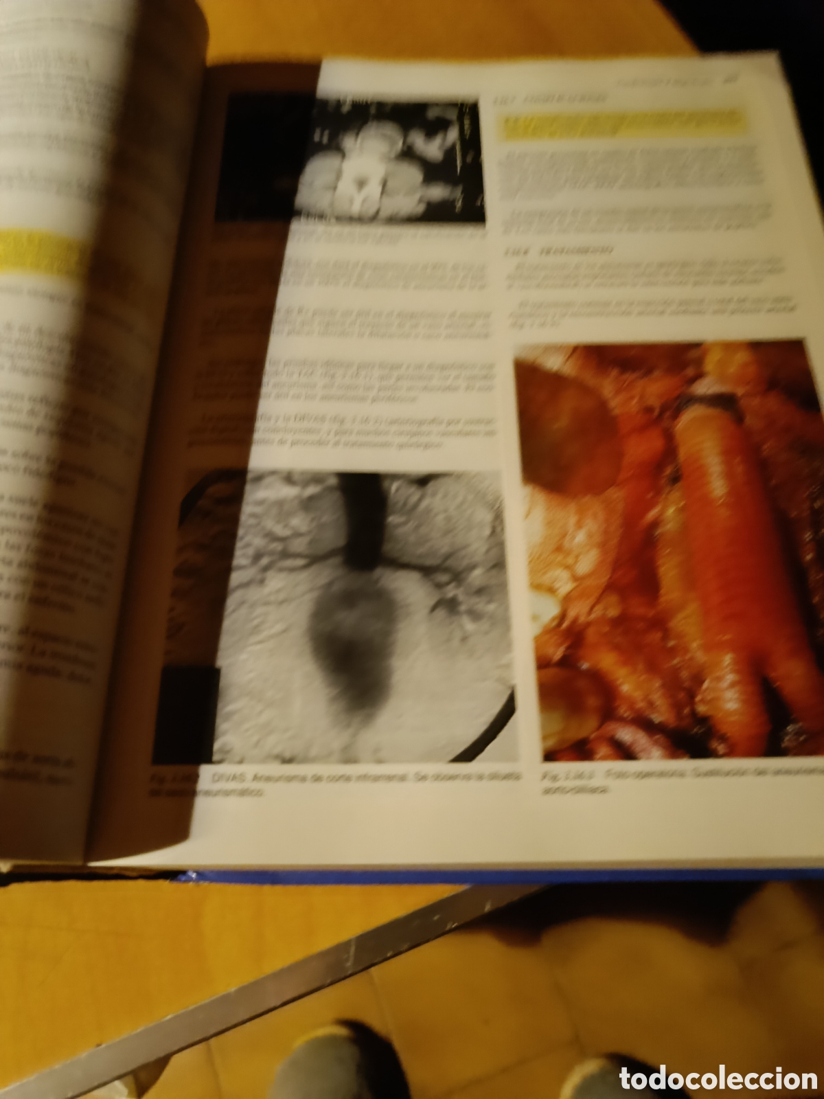 Libros de segunda mano: Medicina interna fundamental - Foto 14