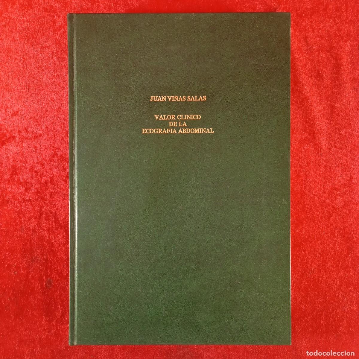Libros de segunda mano: JUAN VI&Ntilde;AS SALAS - TESIS DOCTORAL - TOMO I - VALOR CLINICO DE LA ECOGRAFIA ABDOMINAL / 4965