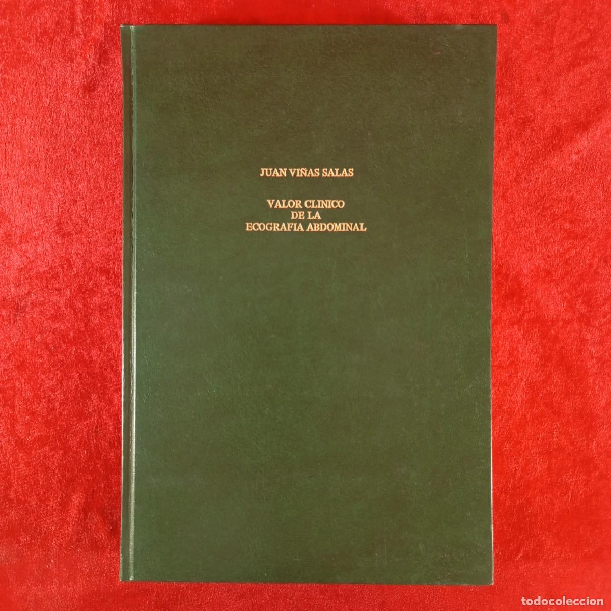 Libros de segunda mano: VALOR CLINICO DE LA ECOGRAFIA ABDOMINAL - JUAN VI&Ntilde;AS SALA - TESIS DOCTORAL - TOMO 2 / 6047