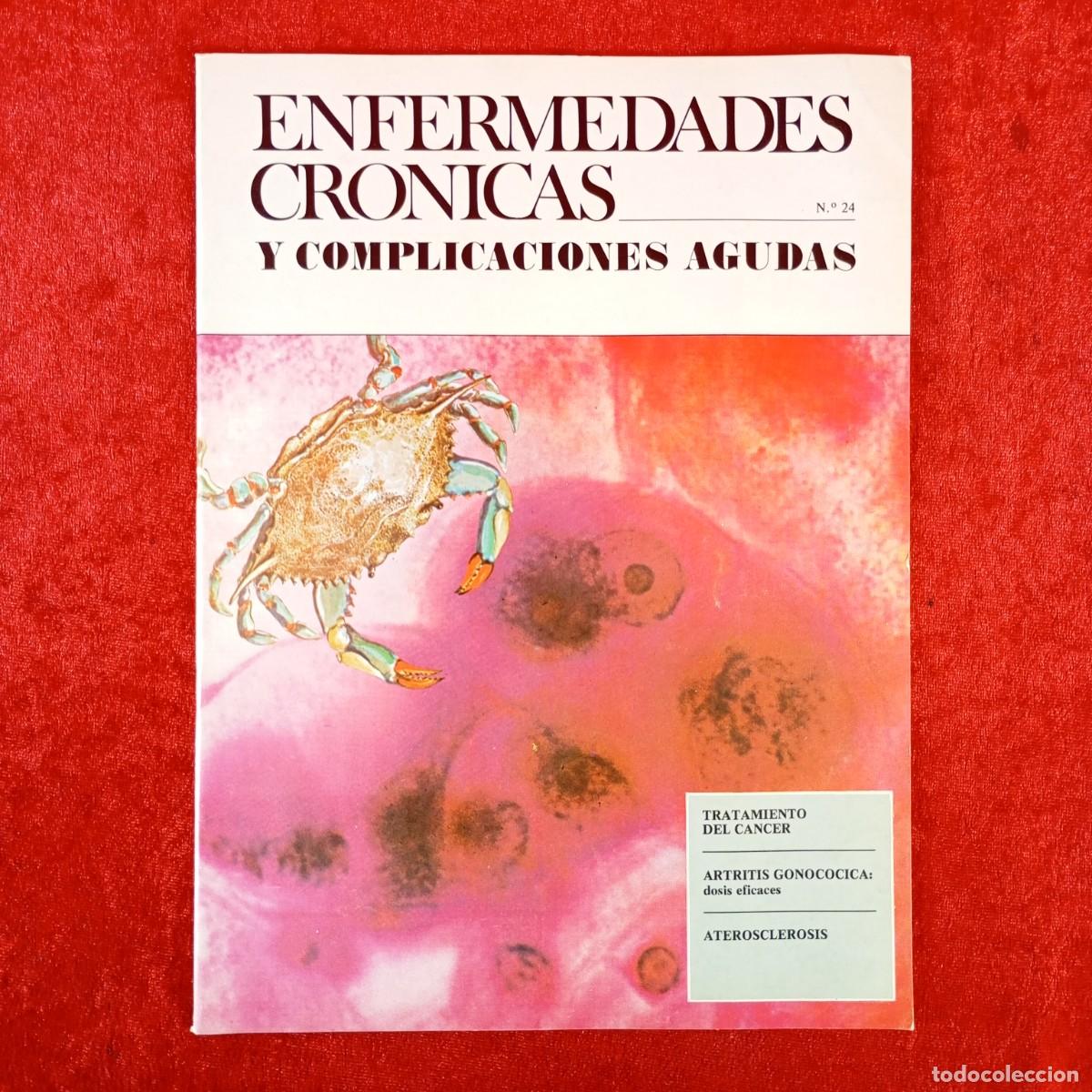 Livres d'occasion: ENFERMEDADES CRONICAS Y COMPLICACIONES AGUDAS - N&ordm; 24 - TRATAMIENTO DEL CANCER / 6109