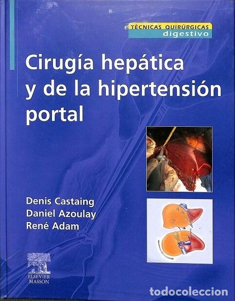 Libros de segunda mano: Cirug&iacute;a Hep&aacute;tica y de la Hipertensi&oacute;n Portal - Denis Castaing, Daniel Azoulay, Ren&eacute; Adam - Elsevier