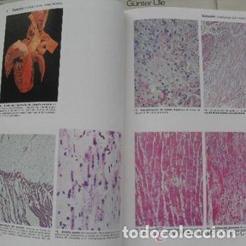 Libros de segunda mano: Atlas Anatom&iacute;a Patol&oacute;gica Wilhelm Doerr Salvat 1979 Completo 6 Fasc&iacute;culos PEIFER