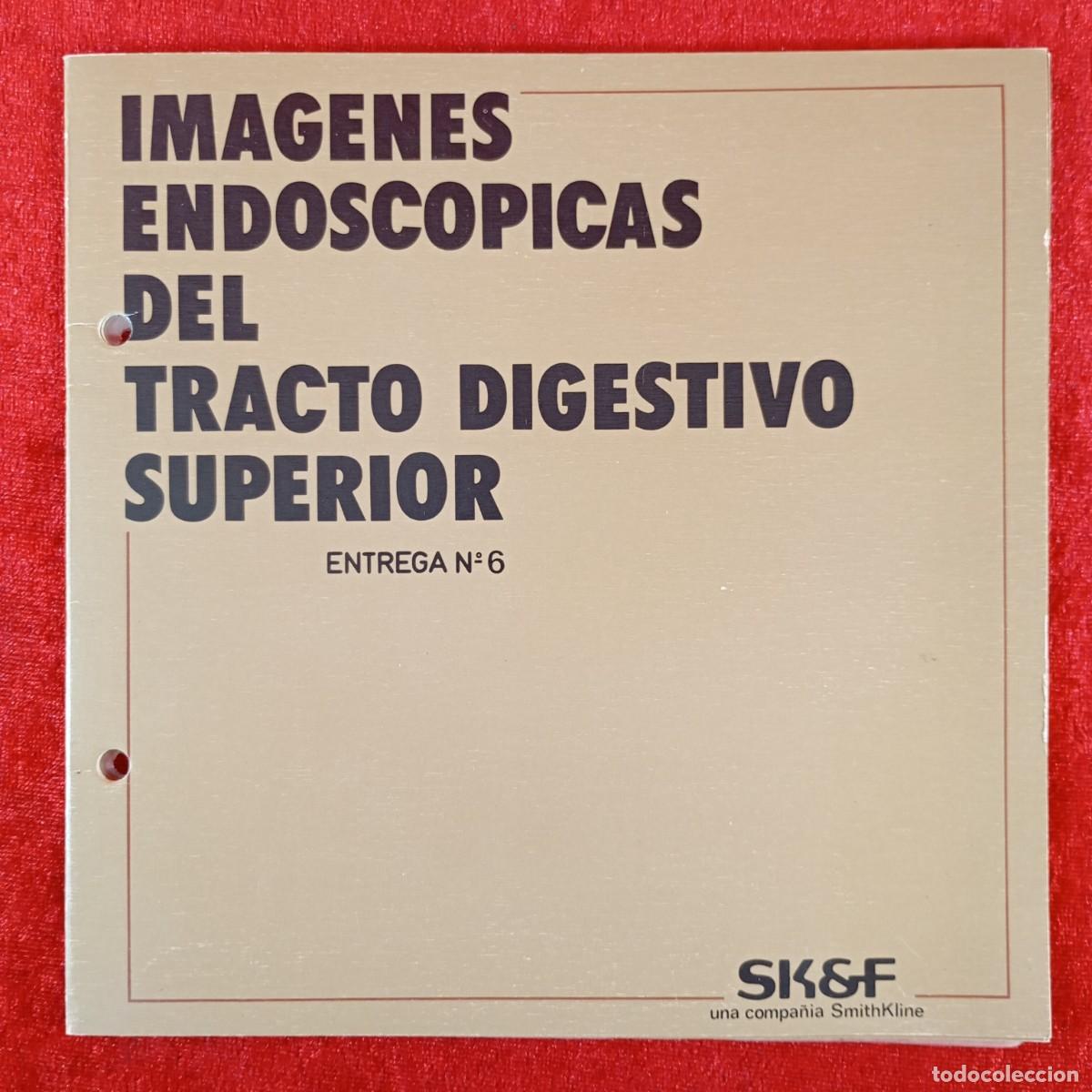 Libros de segunda mano: IMAGENES ENDOSCOPICAS DEL TRACTO DIGESTIVO SUPERIOR - SMITHKLINE - SKSF / 281
