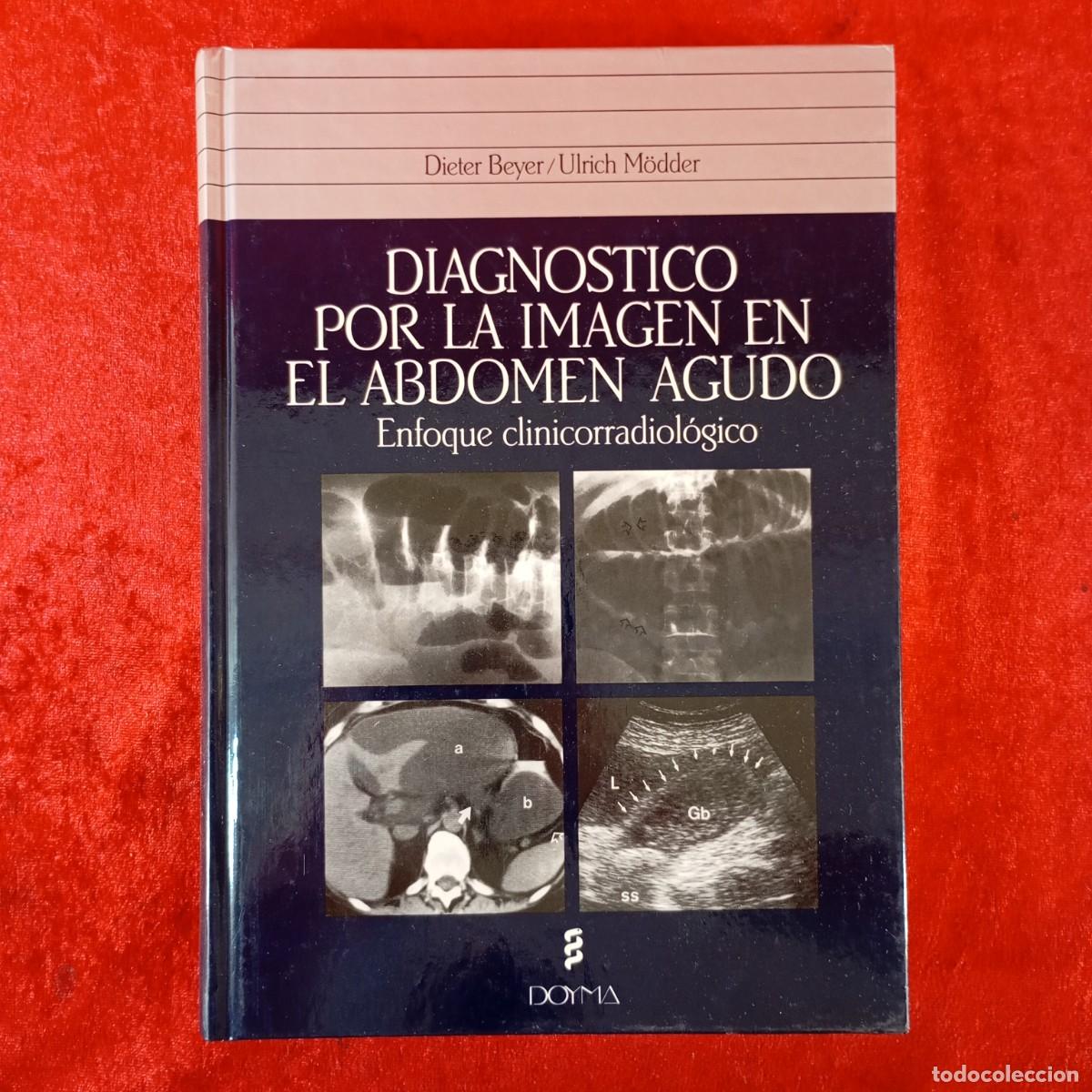 Libros de segunda mano: DIAGNOSTICO POR LA IMAGEN EN EL ABDOMEN AGUDO - ENFOQUE CLINICORRADIOL&Oacute;GICO - DIETER BEYER / 313
