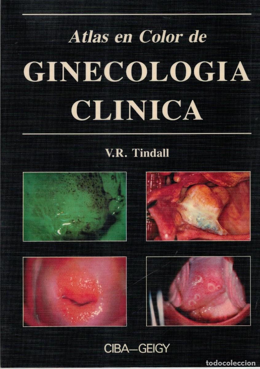 Libros de segunda mano: ATLAS EN COLOR DE GINECOLOGIA CLINICA. TINDALL, V.R. A-MEDI-1722