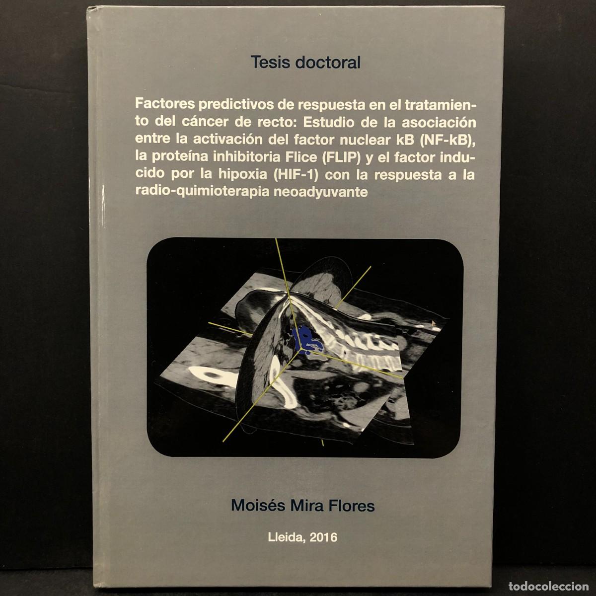 Libros de segunda mano: FACTORES PREDICTIVOS DE RESPUESTA EN EL TRATAMIENTO DEL C&Aacute;NCER DE RECTO - MOIS&Eacute;S MIRA FLORES / 1498