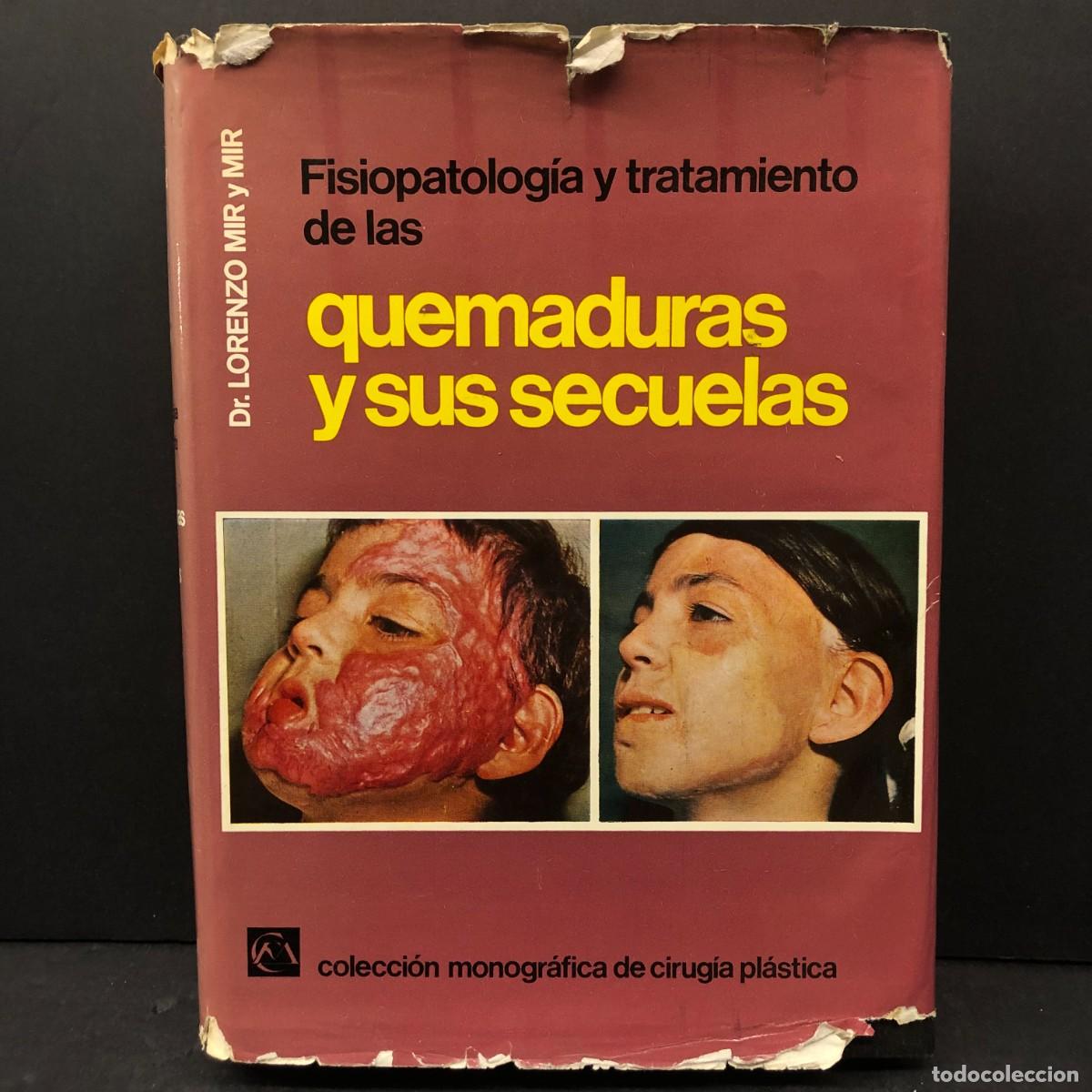 Libros de segunda mano: FISIOPATOLOG&Iacute;A Y TRATAMIENTO DE LAS QUEMADURAS Y SUS SECUELAS - DR. LORENZO MIR Y MIR / 1525