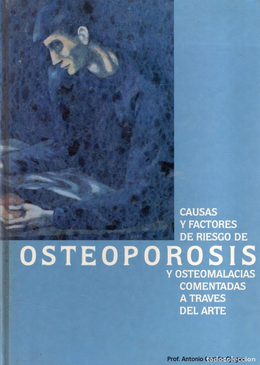 Libros de segunda mano: CAUSAS Y FACTORES DE RIESGO DE OSTEOPOROSIS. CASTILLO OJUGAS, ANTONIO. A-MEDI-1757