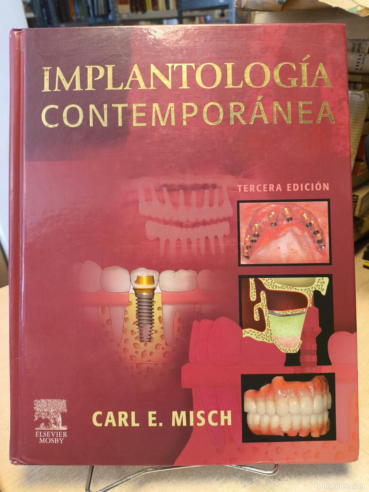Libros de segunda mano: IMPLANTOLOG&Iacute;A CONTEMPOR&Aacute;NEA - ELSEVIER MOSBY 2009 - C.E. Misch