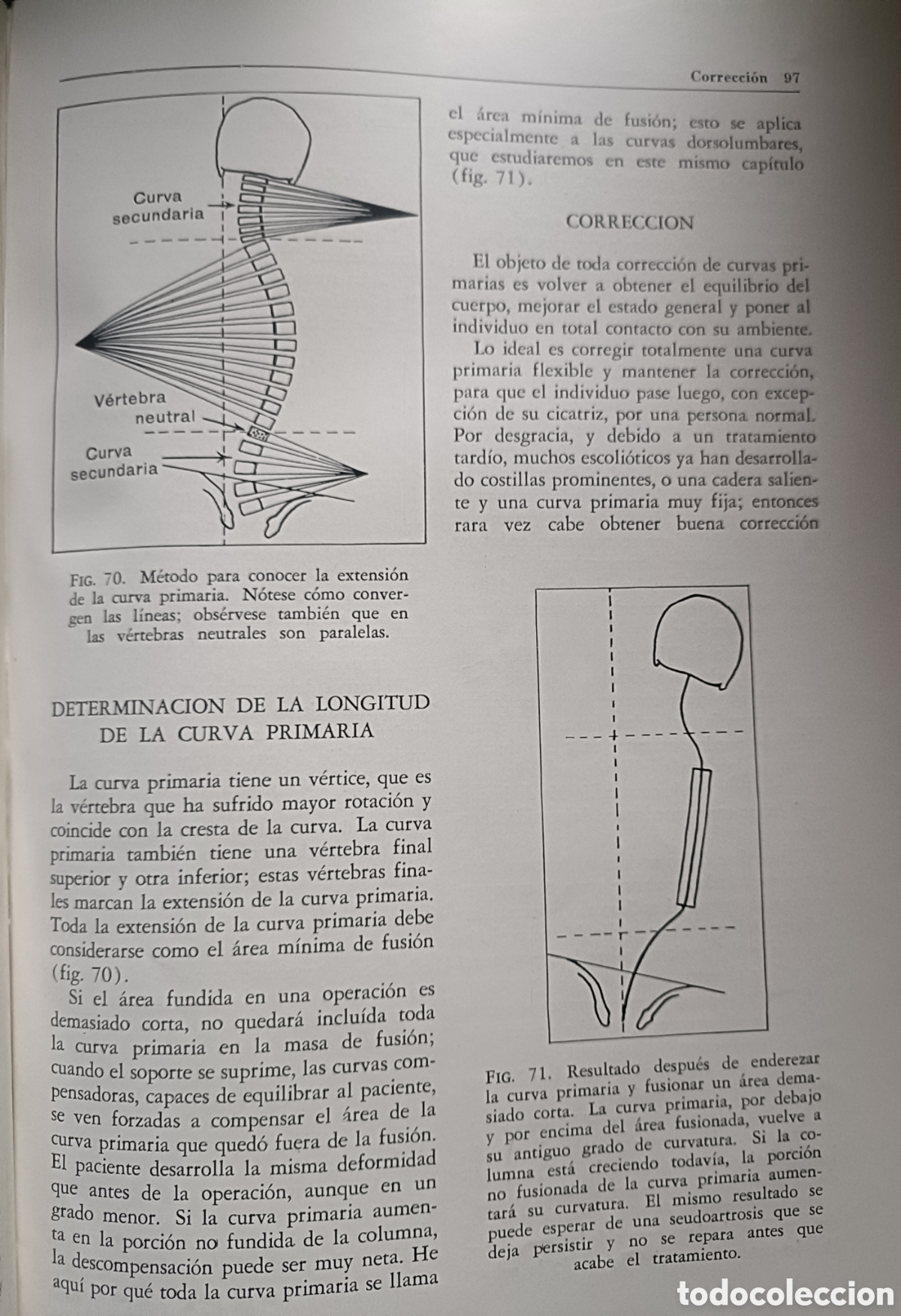 Libros de segunda mano: Libro Ortopedia Pedi&aacute;trica y General - Foto 10