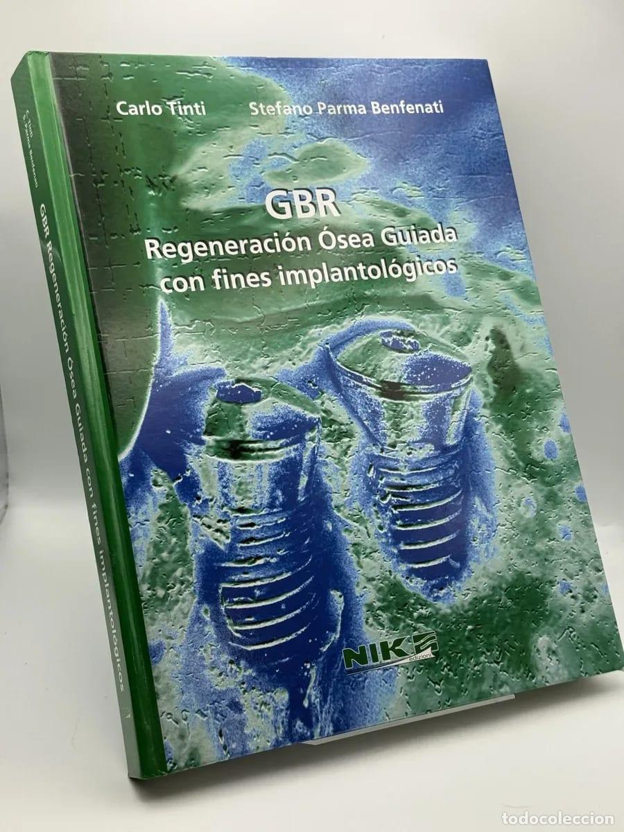 Second hand books: GBR. Regeneraci&oacute;n &oacute;sea guiada con fines implantol&oacute;gicos - Carlo Tinti, Stefano Parma Benfanti