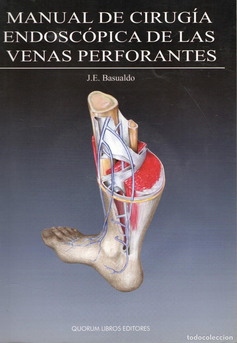 Libros de segunda mano: MANUAL DE CIRUGIA ENDOSCOPICA DE LAS VENAS PERFORANTES. BASUALDO, J. E. ME-458