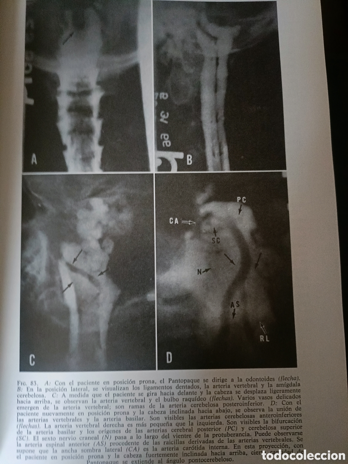 Libros de segunda mano: Libro: Afecciones Columna y M&eacute;dula Espinal - Foto 3