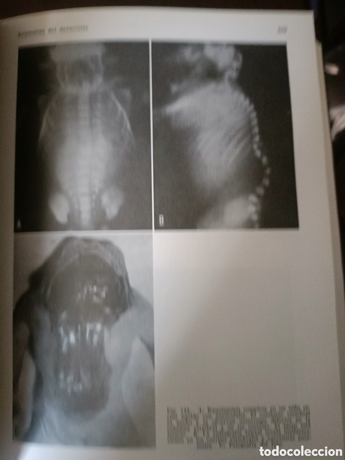 Libros de segunda mano: Libro: Afecciones Columna y M&eacute;dula Espinal - Foto 5