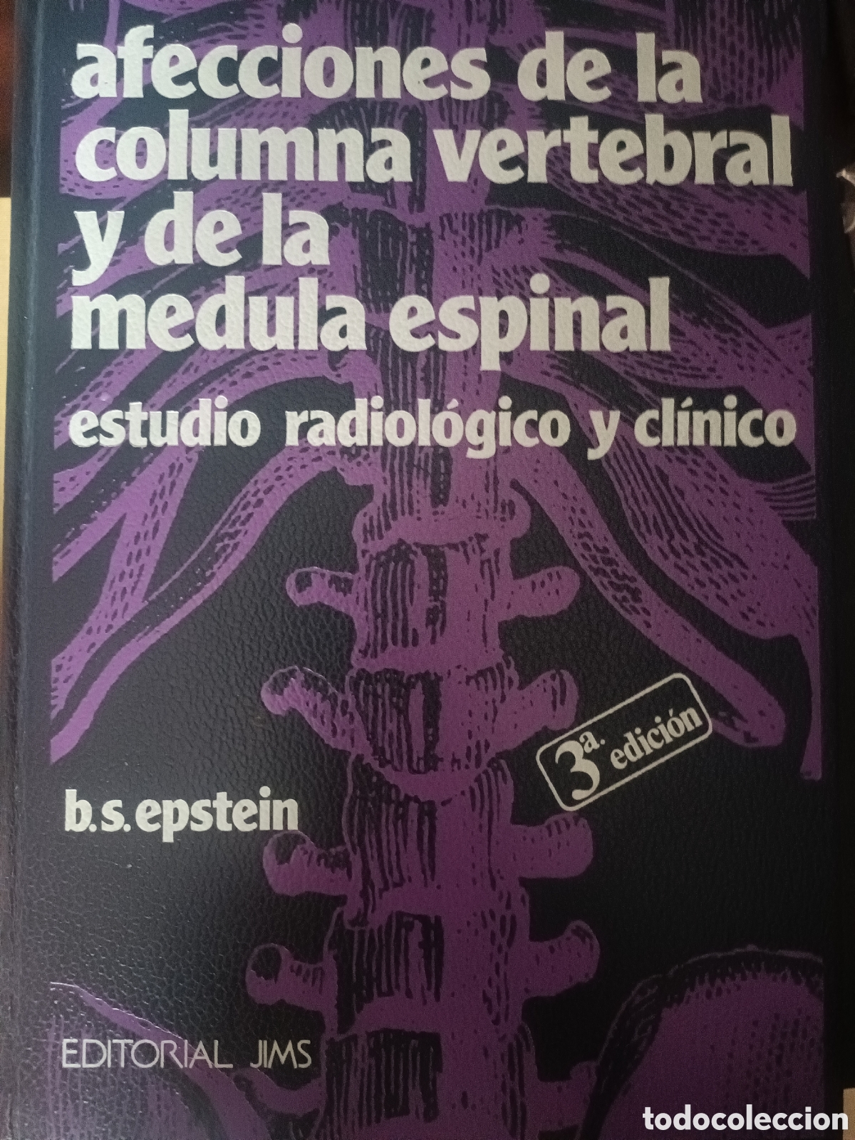Libros de segunda mano: Libro: Afecciones Columna y M&eacute;dula Espinal