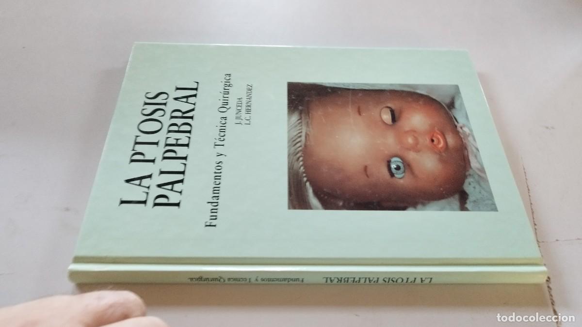 Libros de segunda mano: LA PTOSIS PALPEBRAL / JUNCEDA-HERNANDEZ /GRAV 26/ ALLERGAN / FUNDAMENTOS Y T&Eacute;CNICA QU&Iacute;RURGICA
