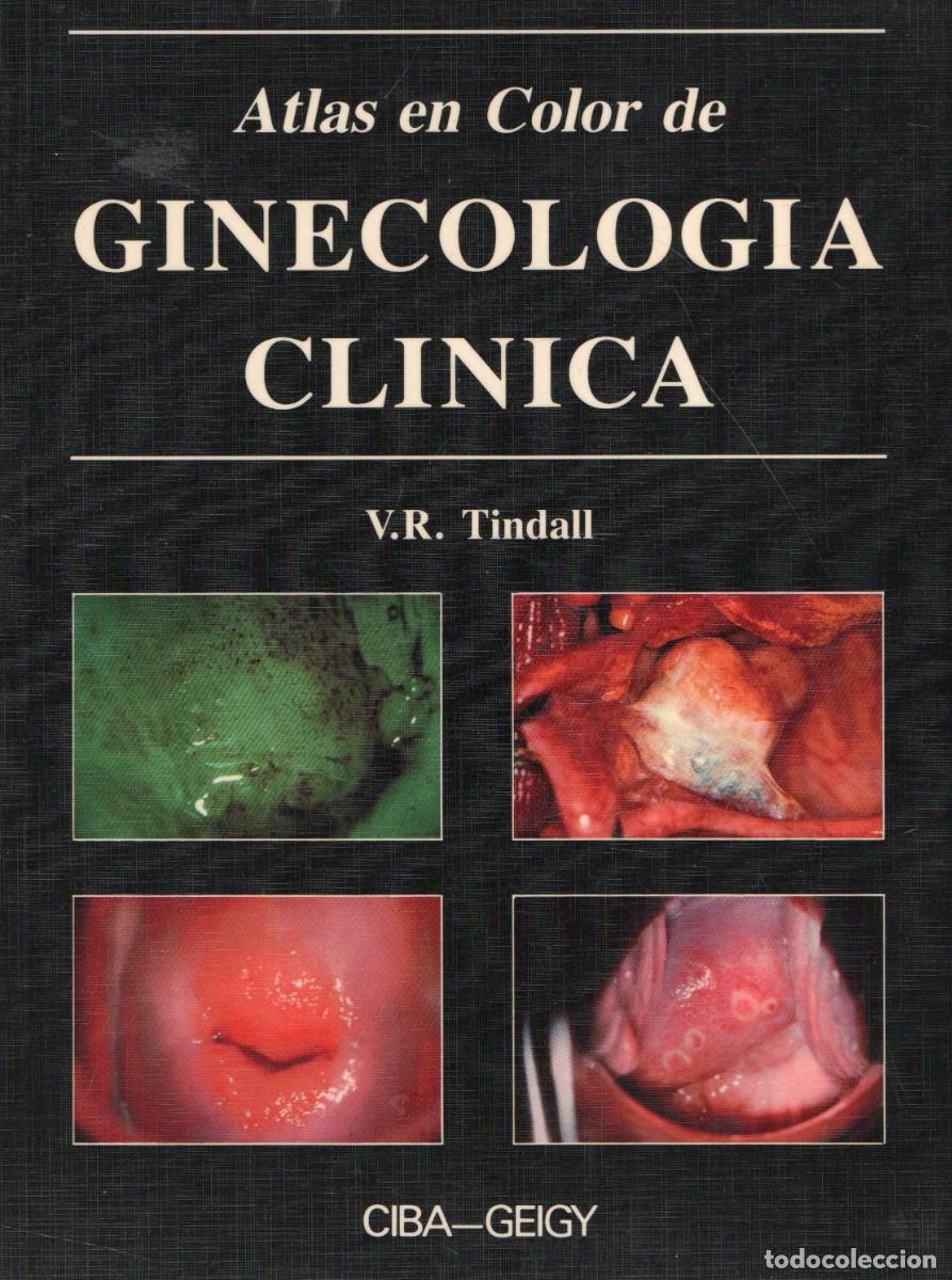 Libros de segunda mano: ATLAS EN COLOR DE GINECOLOGIA CLINICA. TINDALL, V.R. A-MEDI-1836