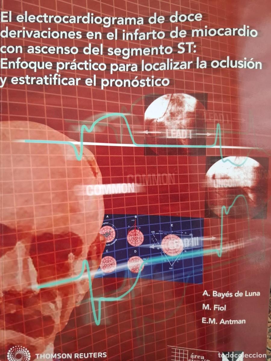 Libros de segunda mano: el electrocardiograma de 12 derivaciones en el infarto de miocardio... A Bay&eacute;s Luna M Fiol EM Antman