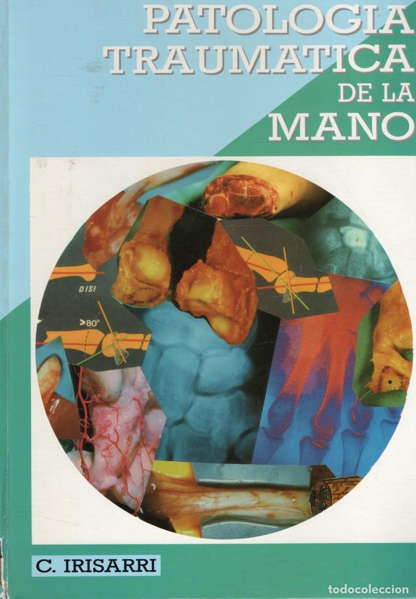 Libros de segunda mano: PATOLOGIA TRAUMATICA DE LA MANO. IRISARRI, CARLOS. A-MEDI-1859