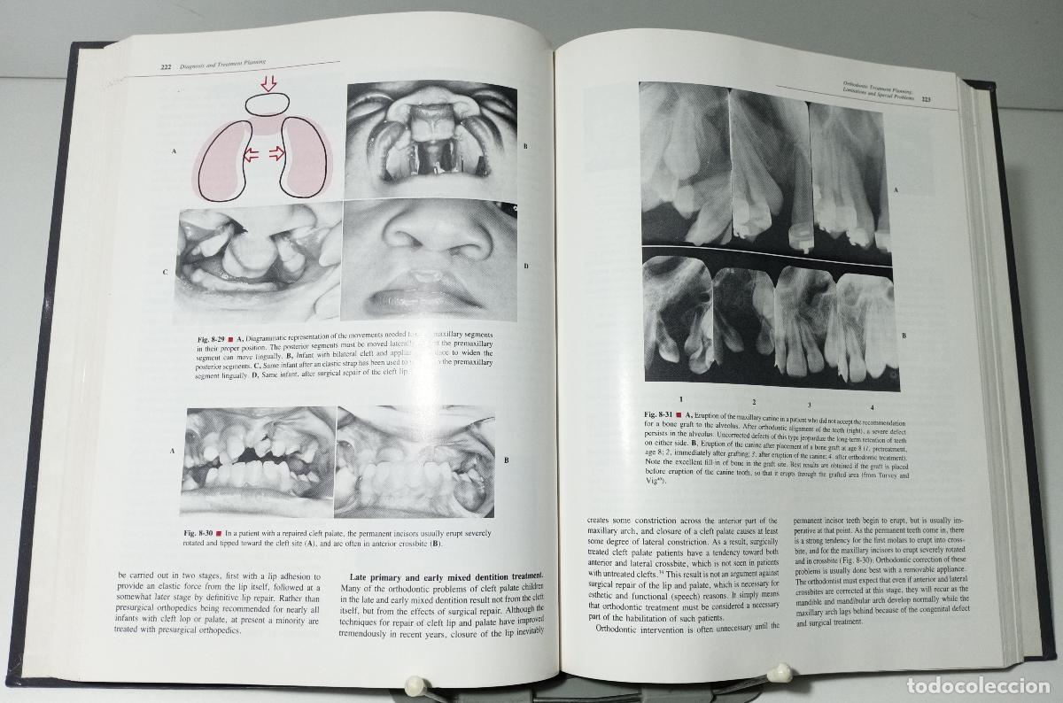 Libros de segunda mano: Contemporary orthodontics - R. Proffit, William - Foto 2