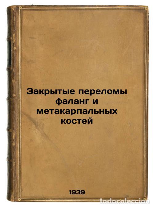 Second hand books: Zakrytye perelomy falang i metakarpal'nykh kostey. In Russian /Closed fracture - Usoltseva, Elena Va
