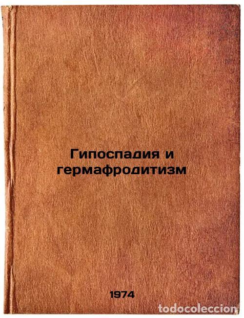 Libri di seconda mano: Gipospadiya i germafroditizm. In Russian /Hypospadia and Hermaphroditism - Savchenko, Nikolai Evseev