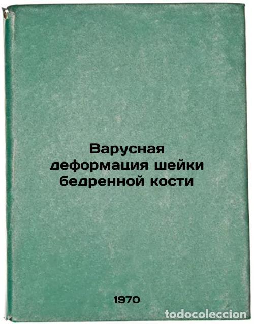 Libri di seconda mano: Varusnaya deformatsiya sheyki bedrennoy kosti. In Russian /Cervical femur warpi - Hook, Arkady Stepa