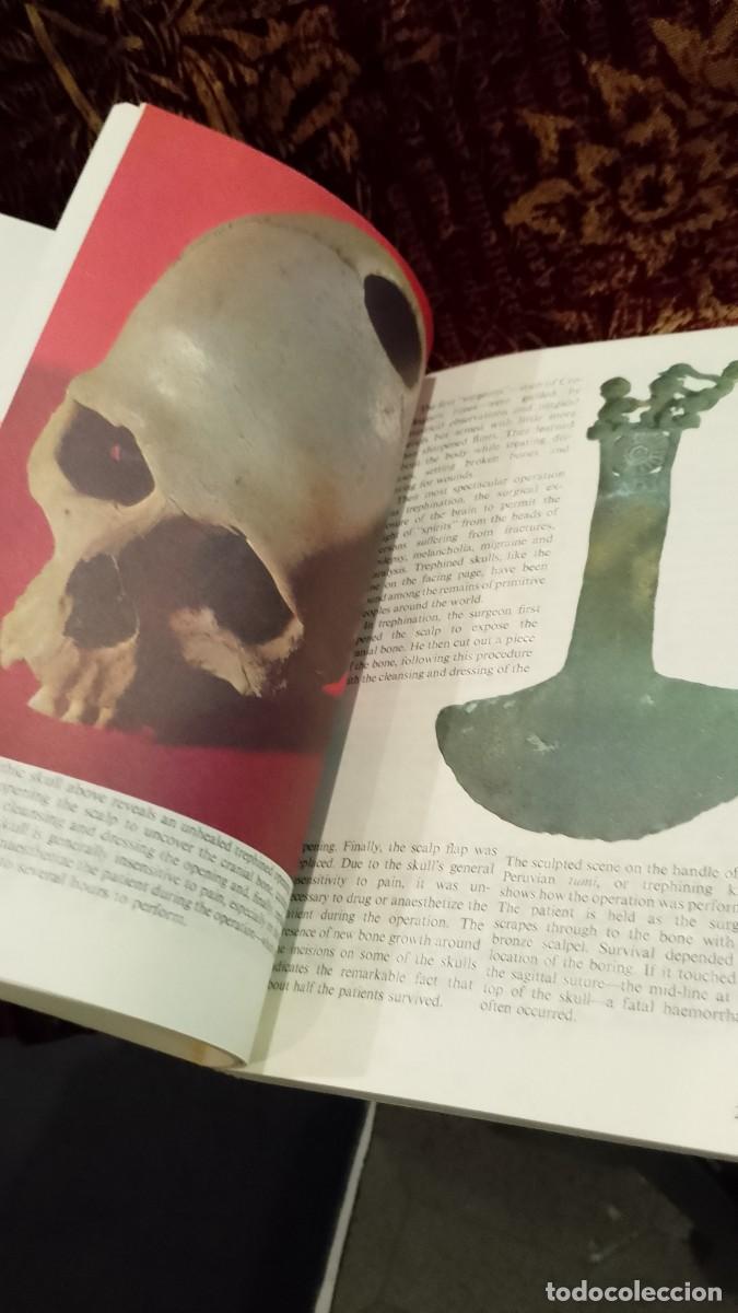 Libros de segunda mano: The Body - Alan E. Nourse - Foto 8