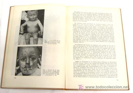 Libros de segunda mano: El Eczema del Lactante Editorial Alhambra a&ntilde;os 40 - Foto 2