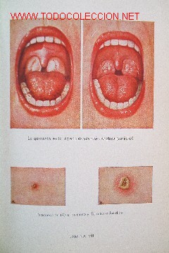 Libros de segunda mano: EL CONSEJERO MEDICO DEL HOGAR - Foto 6