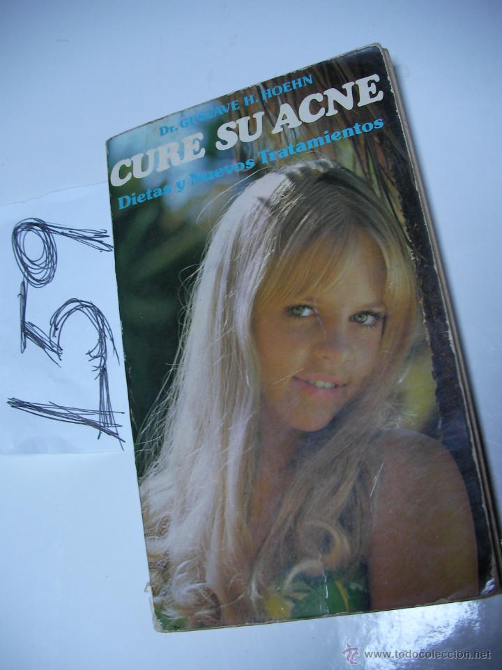 Libros de segunda mano: CURE SU ACNE - ENVIO GRATIS A ESPA&Ntilde;A - Foto 1