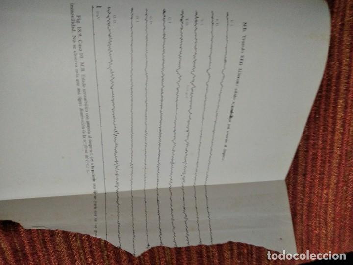 Libros de segunda mano: Libro Tratado de Hipnosis Sofrologia de Franco Granone 1973 - Foto 20